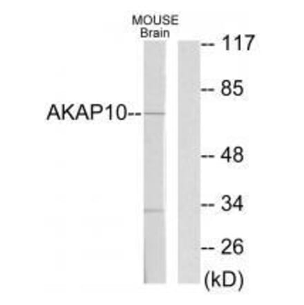 Western blot - AKAP10 Antibody from Signalway Antibody (33587) - Antibodies.com