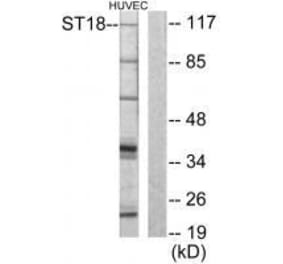 Western blot - ZNF387 Antibody from Signalway Antibody (33593) - Antibodies.com