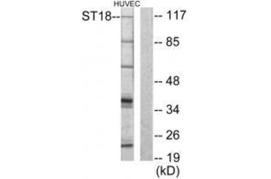Western blot - ZNF387 Antibody from Signalway Antibody (33593) - Antibodies.com