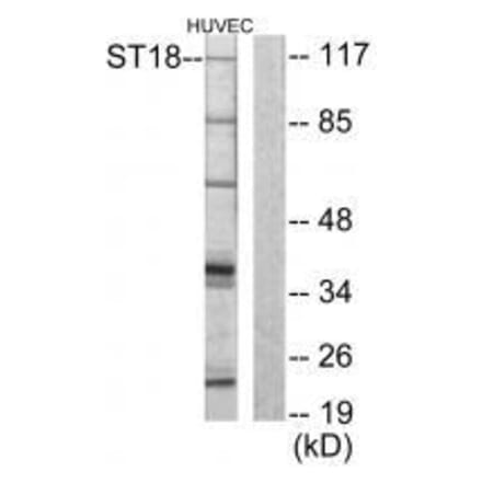 Western blot - ZNF387 Antibody from Signalway Antibody (33593) - Antibodies.com