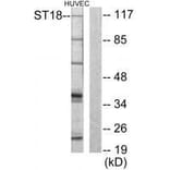 Western blot - ZNF387 Antibody from Signalway Antibody (33593) - Antibodies.com