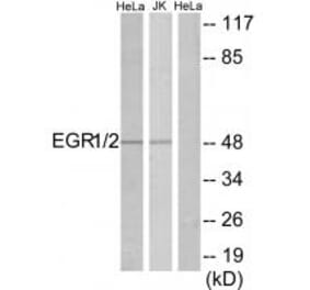 Western blot - EGR1/2 Antibody from Signalway Antibody (33701) - Antibodies.com