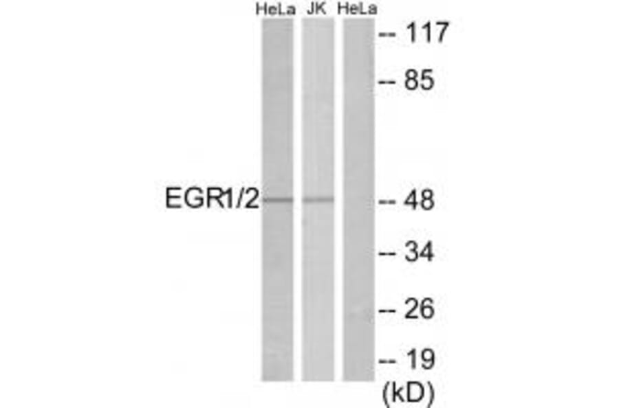 Western blot - EGR1/2 Antibody from Signalway Antibody (33701) - Antibodies.com