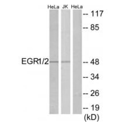 Western blot - EGR1/2 Antibody from Signalway Antibody (33701) - Antibodies.com