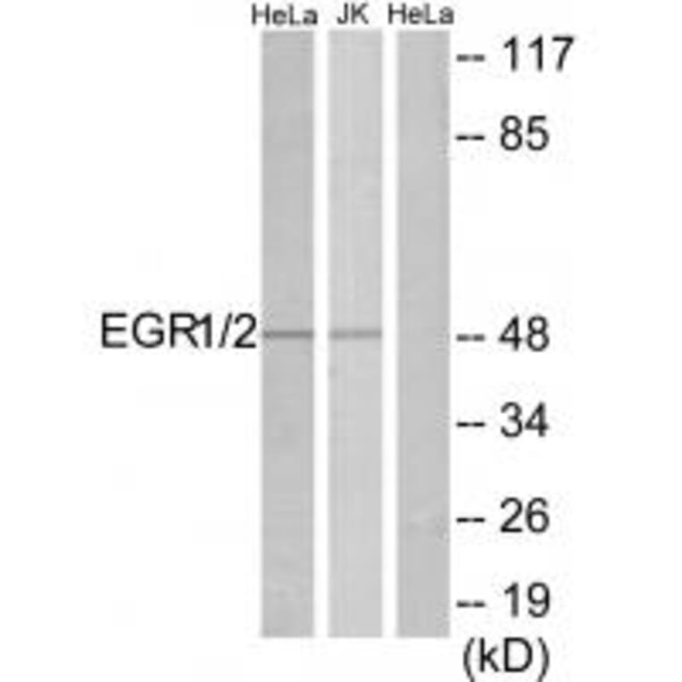 Western blot - EGR1/2 Antibody from Signalway Antibody (33701) - Antibodies.com