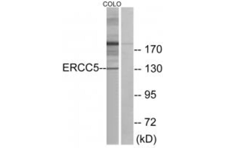 Western blot - ERCC5 Antibody from Signalway Antibody (33738) - Antibodies.com
