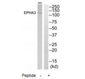 Western blot - EPHA3 Antibody from Signalway Antibody (33740) - Antibodies.com