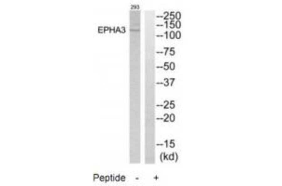 Western blot - EPHA3 Antibody from Signalway Antibody (33740) - Antibodies.com