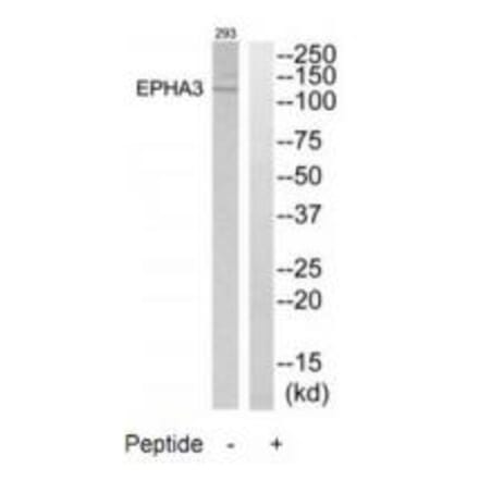 Western blot - EPHA3 Antibody from Signalway Antibody (33740) - Antibodies.com