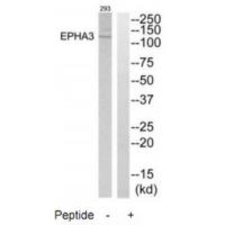 Western blot - EPHA3 Antibody from Signalway Antibody (33740) - Antibodies.com