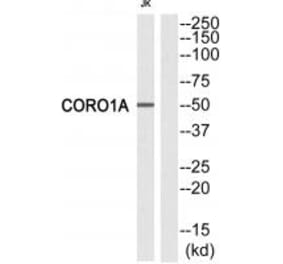 Western blot - CORO1A Antibody from Signalway Antibody (33746) - Antibodies.com