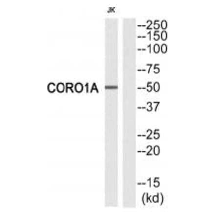 Western blot - CORO1A Antibody from Signalway Antibody (33746) - Antibodies.com