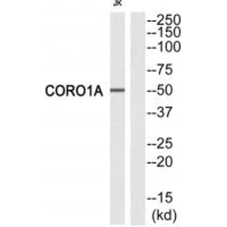 Western blot - CORO1A Antibody from Signalway Antibody (33746) - Antibodies.com