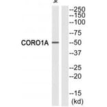 Western blot - CORO1A Antibody from Signalway Antibody (33746) - Antibodies.com