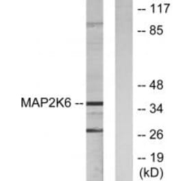 Western blot - MAP2K6 Antibody from Signalway Antibody (33805) - Antibodies.com
