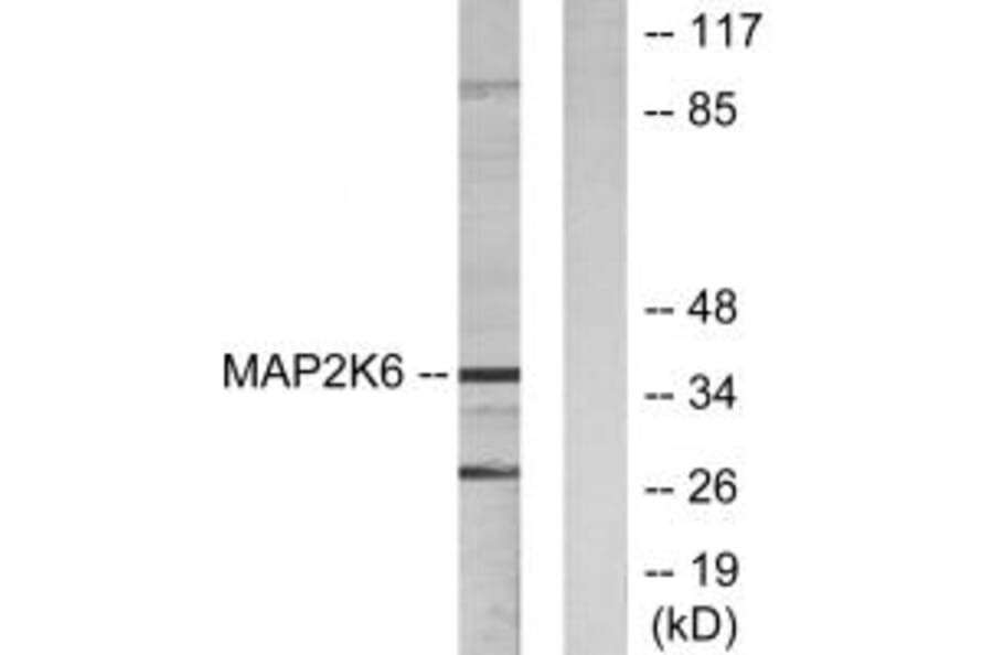 Western blot - MAP2K6 Antibody from Signalway Antibody (33805) - Antibodies.com