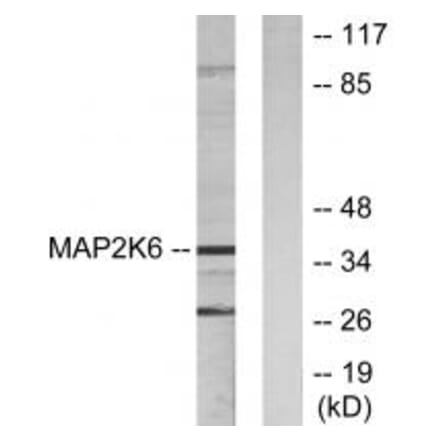 Western blot - MAP2K6 Antibody from Signalway Antibody (33805) - Antibodies.com