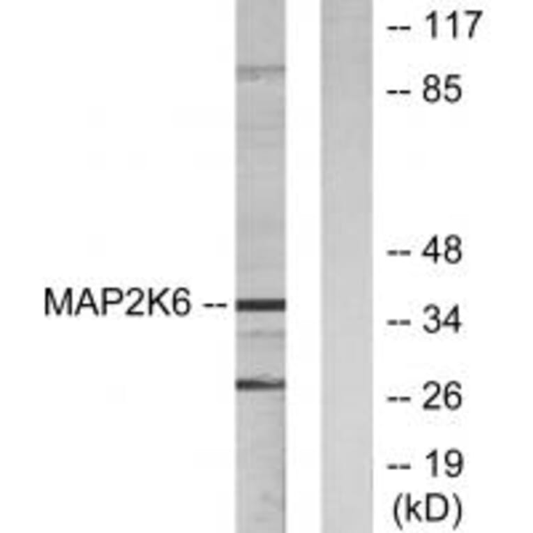 Western blot - MAP2K6 Antibody from Signalway Antibody (33805) - Antibodies.com