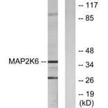 Western blot - MAP2K6 Antibody from Signalway Antibody (33805) - Antibodies.com
