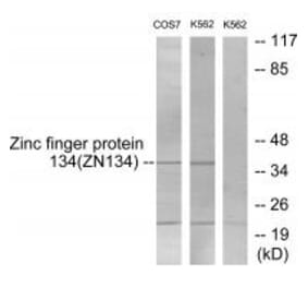 Western blot - ZNF134 Antibody from Signalway Antibody (33807) - Antibodies.com