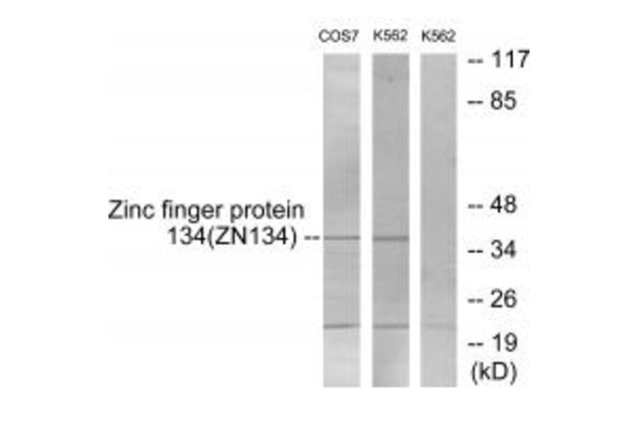 Western blot - ZNF134 Antibody from Signalway Antibody (33807) - Antibodies.com