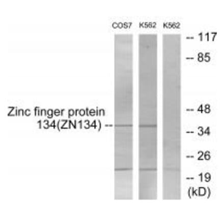Western blot - ZNF134 Antibody from Signalway Antibody (33807) - Antibodies.com