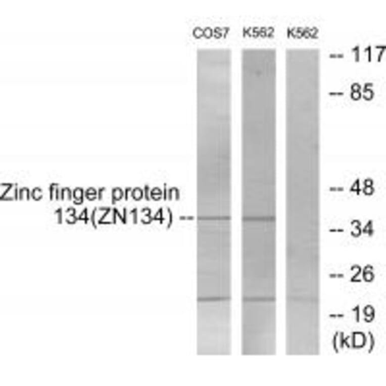 Western blot - ZNF134 Antibody from Signalway Antibody (33807) - Antibodies.com