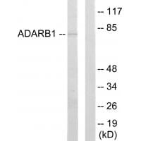 Western blot analysis of extracts from HepG2 cells, using ADARB1 antibody #33838.