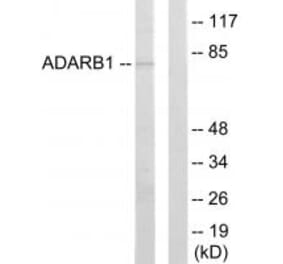Western blot - ADARB1 Antibody from Signalway Antibody (33838) - Antibodies.com