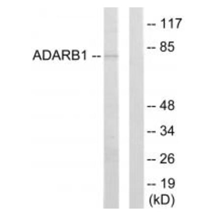Western blot - ADARB1 Antibody from Signalway Antibody (33838) - Antibodies.com