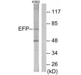 Western blot - ZNF147 Antibody from Signalway Antibody (33878) - Antibodies.com