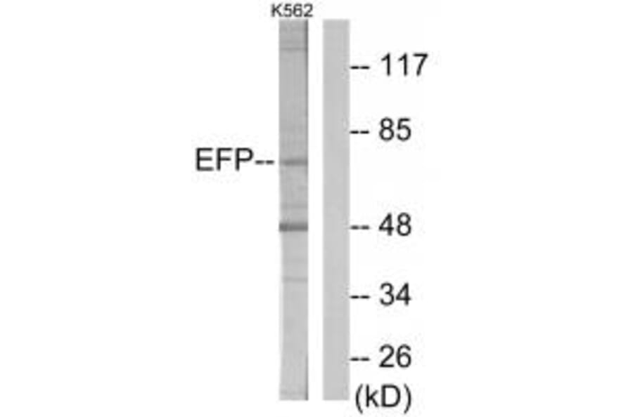 Western blot - ZNF147 Antibody from Signalway Antibody (33878) - Antibodies.com