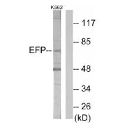 Western blot - ZNF147 Antibody from Signalway Antibody (33878) - Antibodies.com