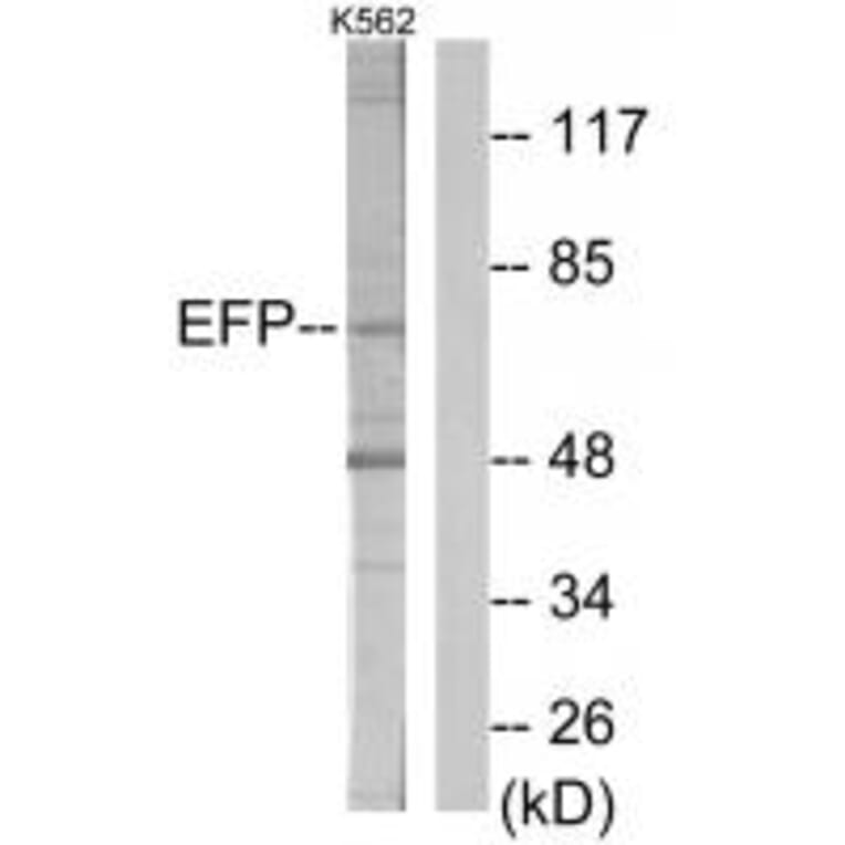 Western blot - ZNF147 Antibody from Signalway Antibody (33878) - Antibodies.com