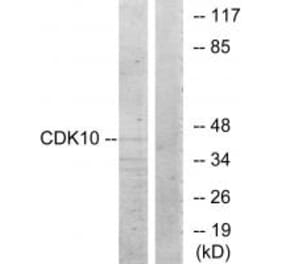 Western blot - CDK10 Antibody from Signalway Antibody (33892) - Antibodies.com