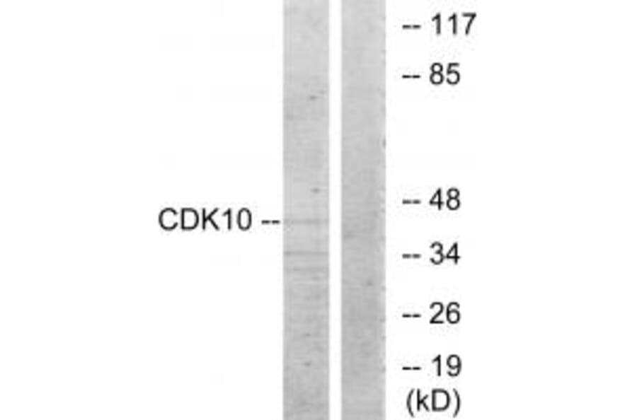 Western blot - CDK10 Antibody from Signalway Antibody (33892) - Antibodies.com