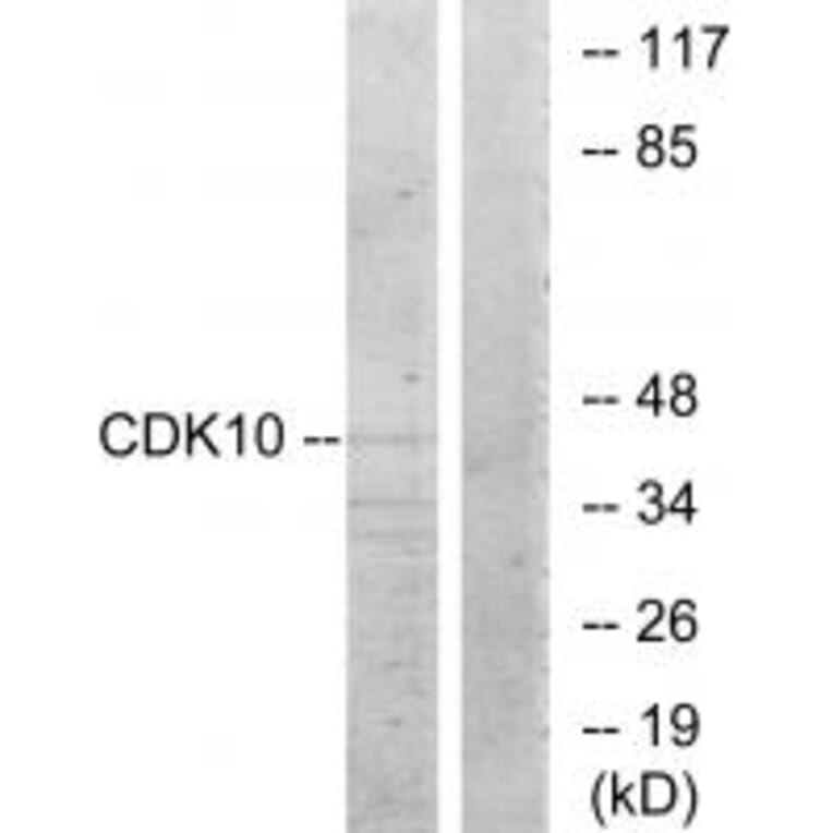 Western blot - CDK10 Antibody from Signalway Antibody (33892) - Antibodies.com