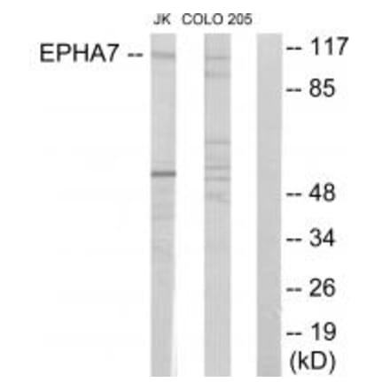 Western blot - EPHA7 Antibody from Signalway Antibody (33896) - Antibodies.com