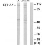 Western blot - EPHA7 Antibody from Signalway Antibody (33896) - Antibodies.com