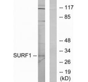 Western blot - SURF1 Antibody from Signalway Antibody (33897) - Antibodies.com