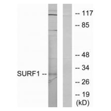 Western blot - SURF1 Antibody from Signalway Antibody (33897) - Antibodies.com