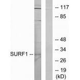 Western blot - SURF1 Antibody from Signalway Antibody (33897) - Antibodies.com