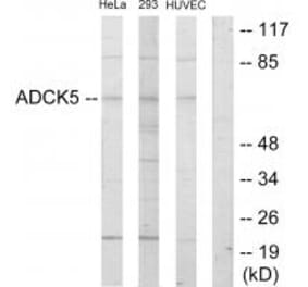 Western blot - ADCK5 Antibody from Signalway Antibody (33921) - Antibodies.com