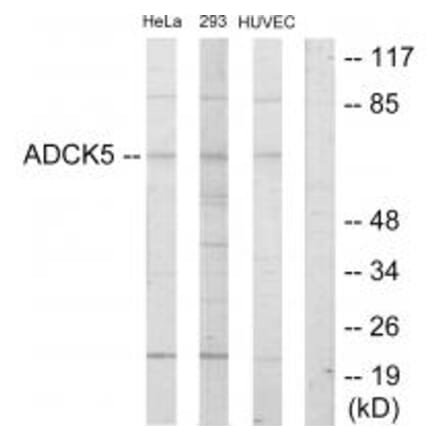 Western blot - ADCK5 Antibody from Signalway Antibody (33921) - Antibodies.com