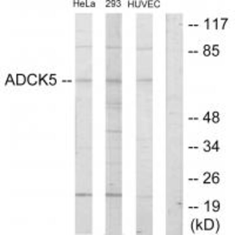 Western blot - ADCK5 Antibody from Signalway Antibody (33921) - Antibodies.com