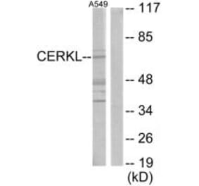 Western blot - CERKL Antibody from Signalway Antibody (33922) - Antibodies.com