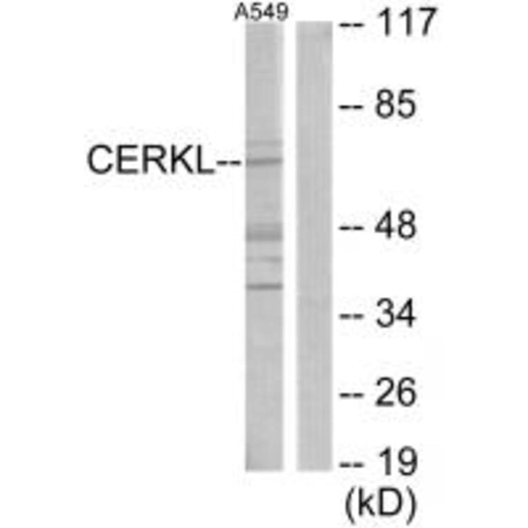 Western blot - CERKL Antibody from Signalway Antibody (33922) - Antibodies.com