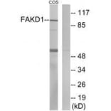 Western blot - FAKD1 Antibody from Signalway Antibody (33925) - Antibodies.com