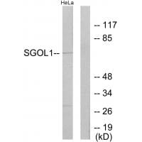 Western blot analysis of extracts from HeLa cells, using SGOL1 antibody #33926.