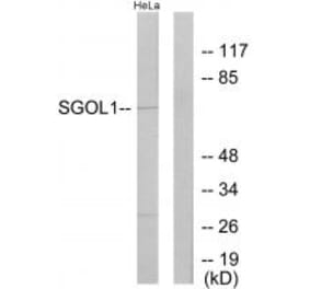 Western blot - SGOL1 Antibody from Signalway Antibody (33926) - Antibodies.com
